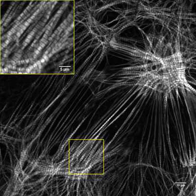 Cell line media